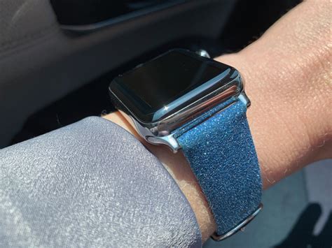 casetify watch band review